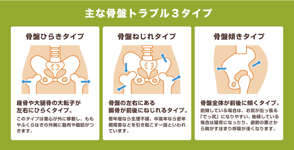 主な骨盤トラブル３タイプ