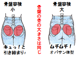 骨盤ズボン