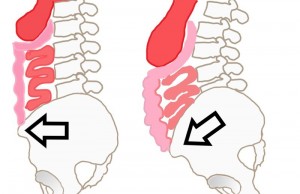 骨盤内蔵