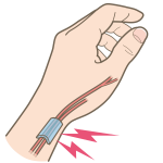 tendon-sheath-inflammation